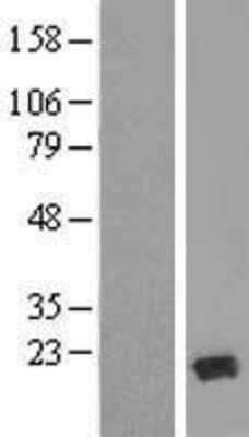 Western Blot: TRAPPC6A Overexpression Lysate (Adult Normal) [NBL1-17260] Left-Empty vector transfected control cell lysate (HEK293 cell lysate); Right -Over-expression Lysate for TRAPPC6A.