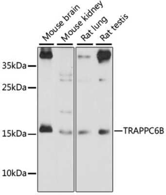 Western Blot TRAPPC6B Antibody - Azide and BSA Free