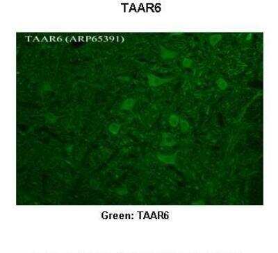 Immunohistochemistry: TRAR4 Antibody [NBP2-86871] - Researcher:Timur Mavlyutov, Ph. D., University of Wisconsin Medical School. Application: IHC. Species+tissue/cell type:Rhesus macaque spinal cord. Primary antibody dilution: 1:300. Secondary antibody: Donkey anti Rabbit 488. Secondary antibody dilution: 1:500