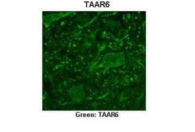 Immunohistochemistry: TRAR4 Antibody [NBP2-86871] - Researcher: Timur Mavlyutov, University of Wisconsin Medical School. Application: IHC. Species+tissue/cell type: Ventral horn region of mouse spinal cord. Primary antibody dilution: 1:200. Secondary antibody: Donkey anti-rabbit CY2. Secondary antibody dilution:1:500