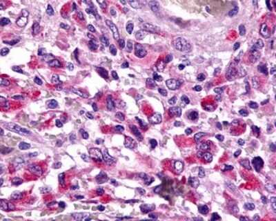 Immunohistochemistry-Paraffin: TRAR4 Antibody [NLS2312] - Analysis of anti-TAAR6 antibody with human brain, glioblastoma.