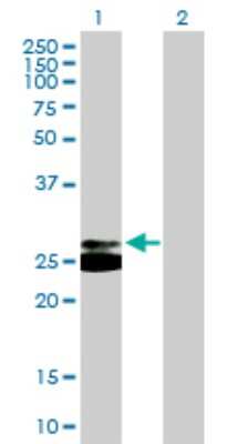 Western Blot: TREM-1 Antibody [H00054210-B01P] - Analysis of TREM1 expression in transfected 293T cell line by TREM1 polyclonal antibody.  Lane 1: TREM1 transfected lysate(25.74 KDa). Lane 2: Non-transfected lysate.