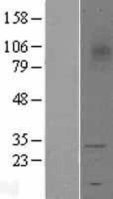 Western Blot TREM1 Overexpression Lysate