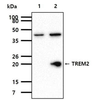 Western Blot: TREM2 Antibody (2B5) [NBP1-07101] - The cell lysates (40ug) were resolved by SDS-PAGE, transferred to PVDF membrane and probed with TREM2 antibody (1:1000). Proteins were visualized using a goat anti-mouse secondary antibody conjugated to HRP and an ECL detection system. Lane 1 : 293T cell lysate. Lane 2 : TREM2 19-161aa Transfected 293T cell lysate