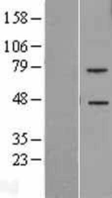 Western Blot: TREML2 Overexpression Lysate (Adult Normal) [NBP2-06287] Left-Empty vector transfected control cell lysate (HEK293 cell lysate); Right -Over-expression Lysate for TREML2.