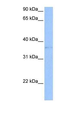 Western Blot: TREML2/TLT-2 Antibody [NBP1-70737] - 721_B cell lysate, concentration 0.2-1 ug/ml.