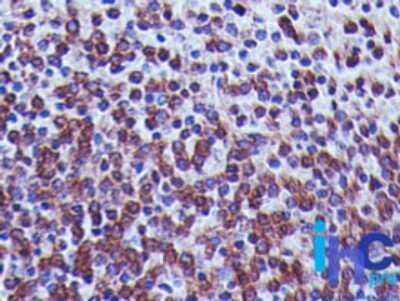 Immunohistochemistry: TREX1 Antibody (41M5F2) - Azide and BSA Free [NBP2-80992] - Human spleen stained with TREX1 antibody (5 ug/ml), peroxidase-conjugate and DAB chromogen. Image from the standard format of this antibody.