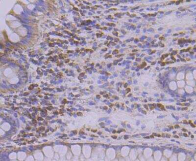 Immunohistochemistry: TREX1 Antibody (JG35-71) [NBP2-76875] - Immunohistochemical analysis of paraffin-embedded human colon tissue using anti-TREX1 antibody. Counter stained with hematoxylin.