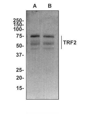 Western Blot: TRF-2 Antibody (3H6B4) [NBP2-26298] - Analysis of (A) Ntera2 and (B) K562 cell lysate using TRF2 antibody at a concentration of 2 ug/ml.