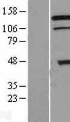Western Blot: TRIAD3 Overexpression Lysate (Adult Normal) [NBL1-15444] Left-Empty vector transfected control cell lysate (HEK293 cell lysate); Right -Over-expression Lysate for TRIAD3.