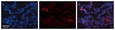 Immunohistochemistry-Paraffin: TRIB1 Antibody [NBP1-55386] - Formalin Fixed Paraffin; Embedded Tissue: Human Lung Tissue; Observed Staining: Cytoplasmic in alveolar type I & II cells; Primary Antibody Concentration: 1:100