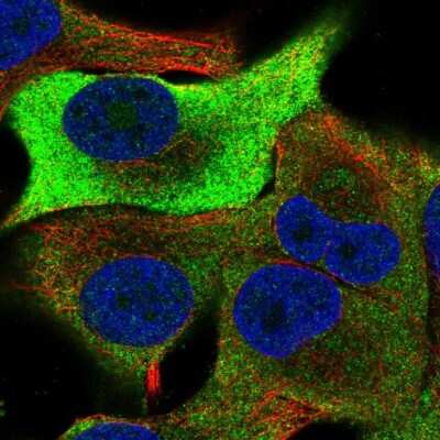 Immunocytochemistry/Immunofluorescence: TRIB1 Antibody [NBP2-56559] - Staining of human cell line SK-MEL-30 shows localization to plasma membrane.