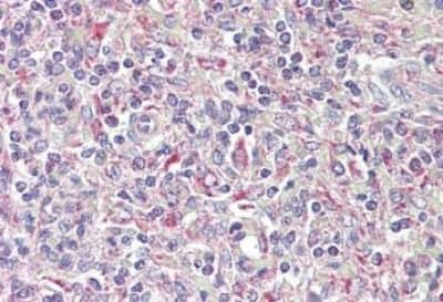 Immunohistochemistry-Paraffin: TRIB1 Antibody [NBP1-20988] - (3.75ug/ml) staining of paraffin embedded Human Spleen. Steamed antigen retrieval with citrate buffer pH 6, AP-staining.