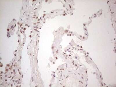 Immunohistochemistry: TRIB1 Antibody (OTI8C8) - Azide and BSA Free [NBP2-74596] - Analysis of Human lung tissue. (Heat-induced epitope retrieval by 1 mM EDTA in 10mM Tris, pH8.5, 120C for 3min)