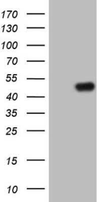 Western Blot: TRIB1 Antibody (OTI8C8) - Azide and BSA Free [NBP2-74596] - Analysis of HEK293T cells were transfected with the pCMV6-ENTRY control (Left lane) or pCMV6-ENTRY TRIB1.