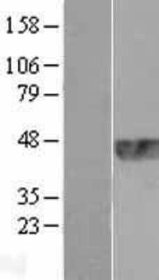 Western Blot: TRIB1 Overexpression Lysate (Adult Normal) [NBL1-17271] Left-Empty vector transfected control cell lysate (HEK293 cell lysate); Right -Over-expression Lysate for TRIB1.