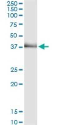 Immunoprecipitation: TRIB2 Antibody (1D11) [H00028951-M11] - Analysis of TRIB2 transfected lysate using anti-TRIB2 monoclonal antibody and Protein A Magnetic Bead, and immunoblotted with TRIB2 rabbit polyclonal antibody.