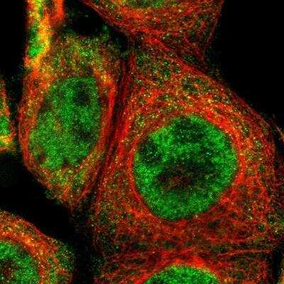 Immunocytochemistry/Immunofluorescence: TRIB2 Antibody [NBP1-83326] - Staining of human cell line A-431 shows positivity in cytoplasm and  nucleus but excluded from the nucleoli. Antibody staining is shown in green.