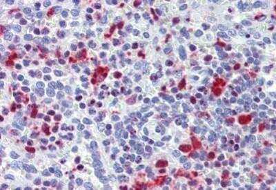 Immunohistochemistry-Paraffin: TRIB2 Antibody [NBP1-52474] - Analysis of anti-TRIB2 antibody with human spleen at concentration 3.75 ug/ml.