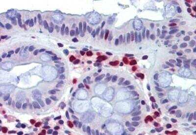 Immunohistochemistry-Paraffin: TRIB2 Antibody [NBP1-52474] - Analysis of anti-TRIB2 antibody with human colon at concentration 3.75 ug/ml.