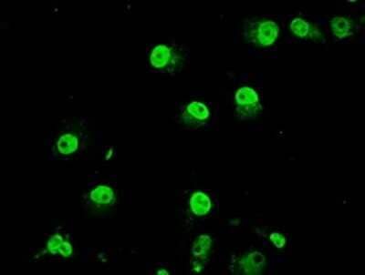 Immunocytochemistry/Immunofluorescence: TRIB2 Antibody (OTI8D11) - Azide and BSA Free [NBP2-74597] - Staining of COS7 cells using anti-TRIB2 mouse monoclonal antibody .