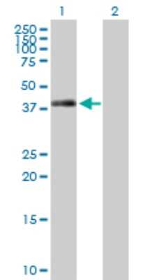 Western Blot: TRIB2 Antibody [H00028951-D01P] - Analysis of TRIB2 expression in transfected 293T cell line by TRIB2 polyclonal antibody.Lane 1: TRIB2 transfected lysate(38.80 KDa).Lane 2: Non-transfected lysate.
