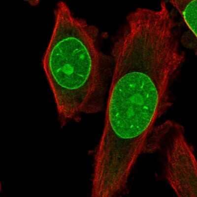 Immunocytochemistry/Immunofluorescence: TRIB3 Antibody [NBP2-56109] - Staining of human cell line PC-3 shows localization to nucleus, nucleoli & nuclear membrane.