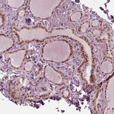 Immunohistochemistry-Paraffin: TRIB3 Antibody [NBP2-56109] - Staining of human thyroid gland shows strong nuclear positivity in glandular cells.