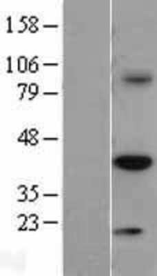 Western Blot: TRIB3 Overexpression Lysate (Adult Normal) [NBL1-17273] Left-Empty vector transfected control cell lysate (HEK293 cell lysate); Right -Over-expression Lysate for TRIB3.