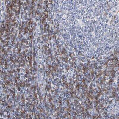 Immunohistochemistry: TRIM Antibody [NBP1-89660] - Staining of human tonsil shows cytoplasmic positivity in lymphoid cells outside the reaction centra.