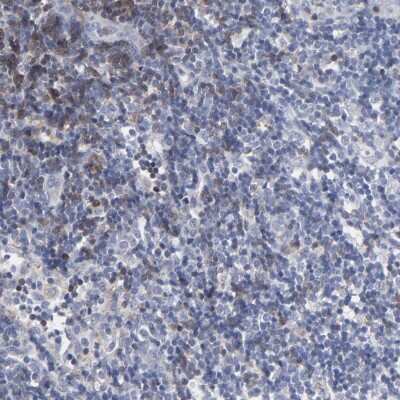 Immunohistochemistry-Paraffin: TRIM Antibody [NBP1-89660] - Staining of human lymph node shows high expression.