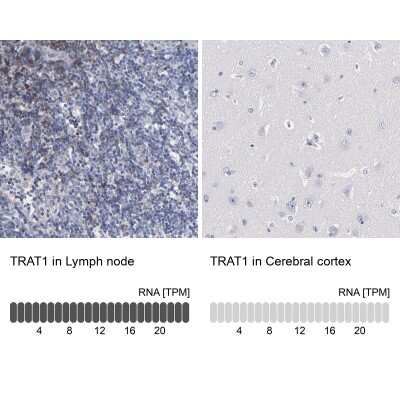 <b>Orthogonal Strategies Validation. </b>Immunohistochemistry-Paraffin: TRIM Antibody [NBP1-89660] - Staining in human lymph node and cerebral cortex tissues using anti-TRAT1 antibody. Corresponding TRAT1 RNA-seq data are presented for the same tissues.