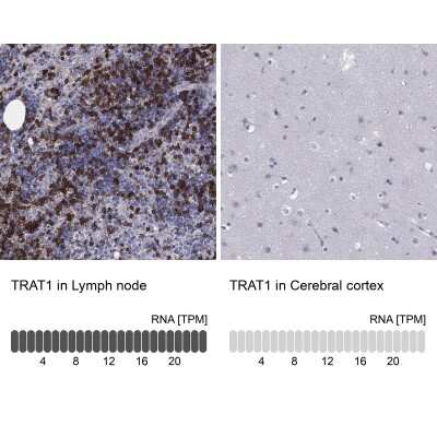 Immunohistochemistry-Paraffin: TRIM Antibody [NBP3-17096] - Analysis in human lymph node and cerebral cortex tissues using Anti-TRAT1 antibody. Corresponding TRAT1 RNA-seq data are presented for the same tissues.