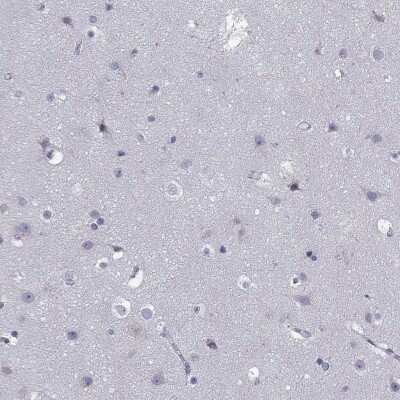 Immunohistochemistry-Paraffin: TRIM Antibody [NBP3-17096] - Staining of human cerebral cortex shows low expression as expected.