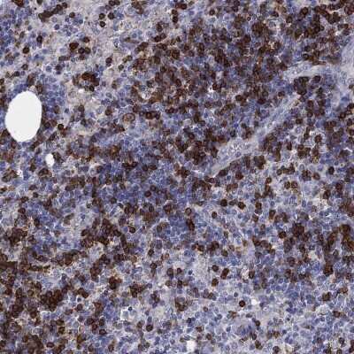 Immunohistochemistry-Paraffin: TRIM Antibody [NBP3-17096] - Staining of human lymph node shows high expression.