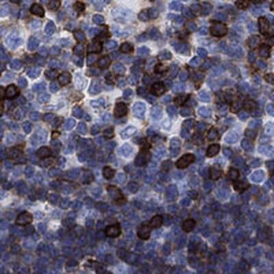 Immunohistochemistry-Paraffin: TRIM Antibody [NBP3-17096] - Staining of human thymus shows membranous positivity in medulla and cortex.