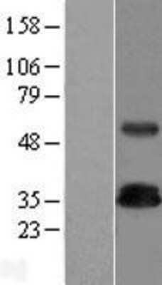 Western Blot: TRIM Overexpression Lysate (Adult Normal) [NBP2-07044] Left-Empty vector transfected control cell lysate (HEK293 cell lysate); Right -Over-expression Lysate for TRIM.