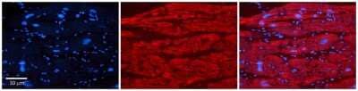 Immunohistochemistry-Paraffin: TRIM10 Antibody [NBP2-85983] - Rabbit Anti-TRIM10 Antibody. Formalin Fixed Paraffin Embedded Tissue: Human Adult heart. Observed Staining: Cytoplasmic. Primary Antibody Concentration: 1:600. Secondary Antibody: Donkey anti-Rabbit-Cy2/3. Secondary Antibody Concentration: 1:200. Magnification: 20X.