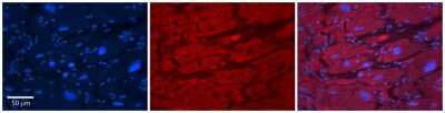 Immunohistochemistry-Paraffin: TRIM10 Antibody [NBP2-85984] - Rabbit Anti-TRIM10 Antibody. Formalin Fixed Paraffin Embedded Tissue: Human Adult heart. Observed Staining: Cytoplasmic. Primary Antibody Concentration: 1:100. Secondary Antibody: Donkey anti-Rabbit-Cy2/3. Secondary Antibody Concentration: 1:200. Magnification: 20X.
