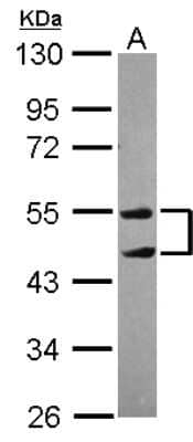 Western Blot: TRIM10 Antibody [NBP2-20704] - Sample (30 ug of whole cell lysate) A: NT2D1 10% SDS PAGE gel, diluted at 1:1000.