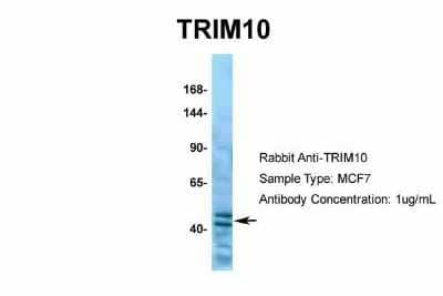 Western Blot: TRIM10 Antibody [NBP2-85982] - Host: Rabbit. Target Name: TRIM10. Sample Type: MCF7. Antibody Dilution: 1.0ug/ml