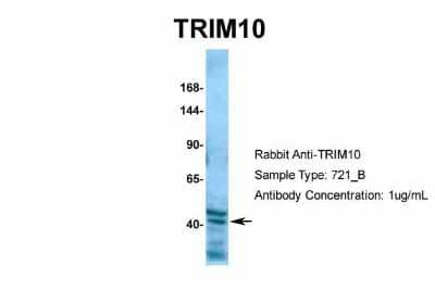 Western Blot: TRIM10 Antibody [NBP2-85982] - Host: Rabbit. Target Name: TRIM10. Sample Type: 721_B. Antibody Dilution: 1.0ug/mlThere is BioGPS gene expression data showing that TRIM10 is expressed in 721_B