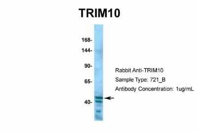 Western Blot: TRIM10 Antibody [NBP2-85982] - Host: Rabbit. Target Name: TRIM10. Sample Type: Hela. Antibody Dilution: 1.0ug/ml