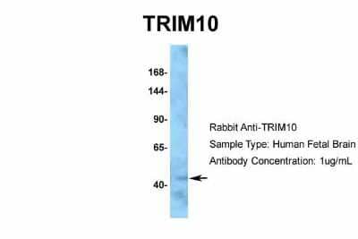 Western Blot: TRIM10 Antibody [NBP2-85982] - Host: Rabbit. Target Name: TRIM10. Sample Type: Human Fetal Brain. Antibody Dilution: 1.0ug/ml