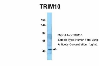 Western Blot: TRIM10 Antibody [NBP2-85982] - Host: Rabbit. Target Name: TRIM10. Sample Type: Human Fetal Lung. Antibody Dilution: 1.0ug/ml