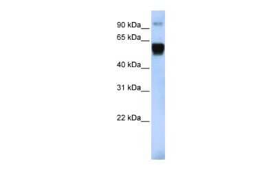 Western Blot: TRIM10 Antibody [NBP2-85983] - WB Suggested Anti-TRIM10 Antibody Titration: 0.2-1 ug/ml. ELISA Titer: 1:312500. Positive Control: Human Lung