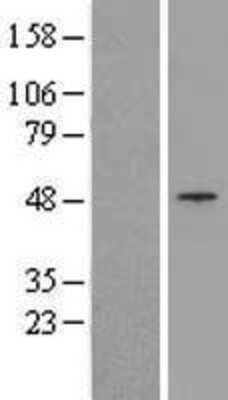 Western Blot: TRIM13 Overexpression Lysate (Adult Normal) [NBP2-05864] Left-Empty vector transfected control cell lysate (HEK293 cell lysate); Right -Over-expression Lysate for TRIM13.