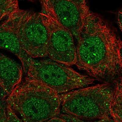 Immunocytochemistry/Immunofluorescence: TRIM14 Antibody [NBP2-47596] - Immunofluorescent staining of human cell line MCF7 shows localization to nucleoplasm & cytosol.