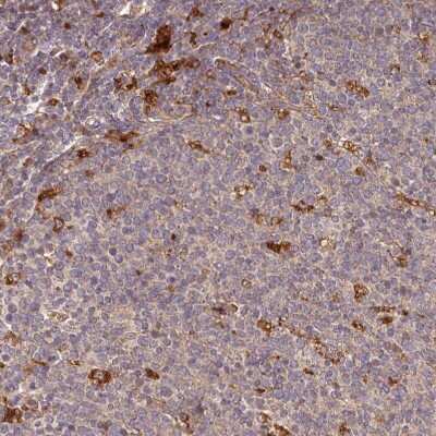 Immunohistochemistry-Paraffin: TRIM14 Antibody [NBP2-47596] - Staining of human tonsil shows moderate cytoplasmic positivity.