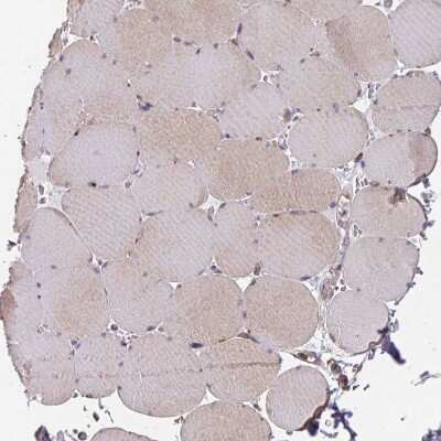Immunohistochemistry-Paraffin: TRIM14 Antibody [NBP2-47596] - Staining of human skeletal muscle shows very weak cytoplasmic positivity in myocytes.